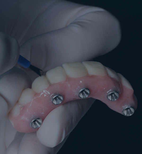 Treatment - North Down Dental