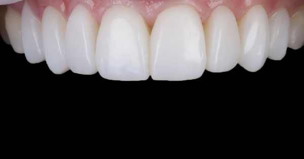 After - North Down Dental