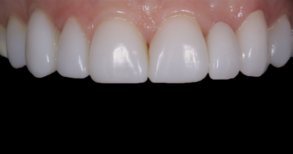 After - North Down Dental