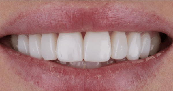 After - North Down Dental