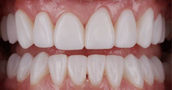 After - North Down Dental