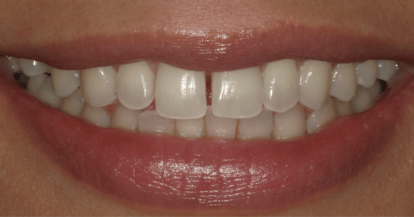 Before - North Down Dental