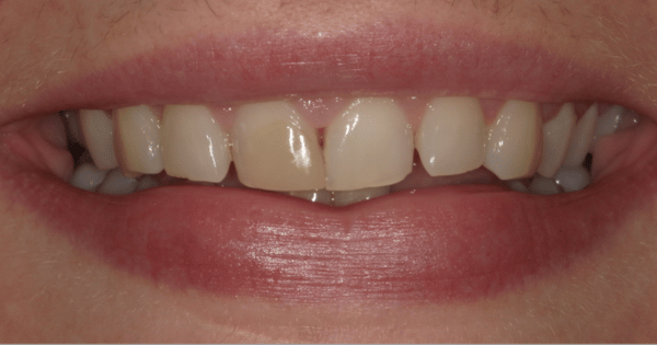 Before - North Down Dental