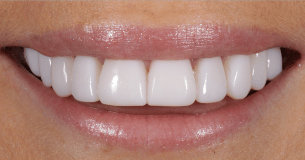 After - North Down Dental