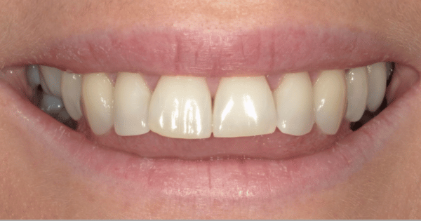 Before - North Down Dental