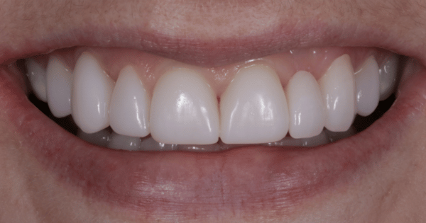 After - North Down Dental