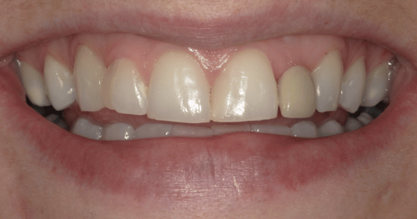 Before - North Down Dental