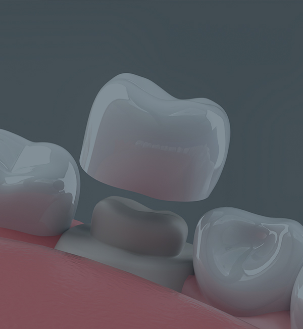 Treatment - North Down Dental