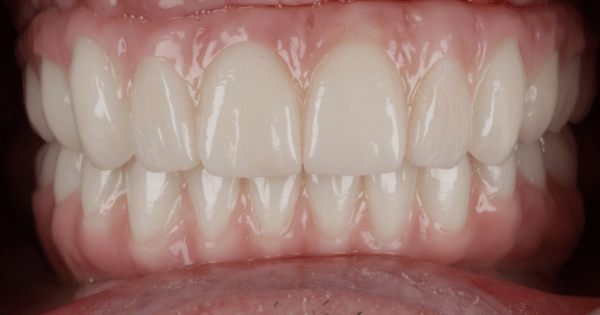 After - North Down Dental