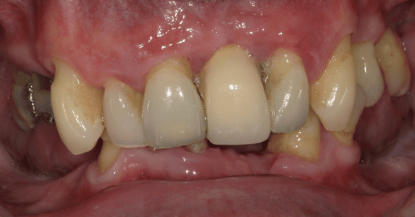 Before - North Down Dental