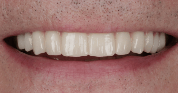 After - North Down Dental