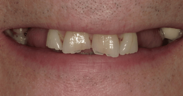 Before - North Down Dental