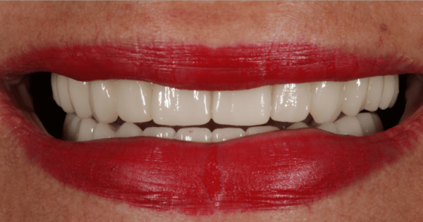 After - North Down Dental