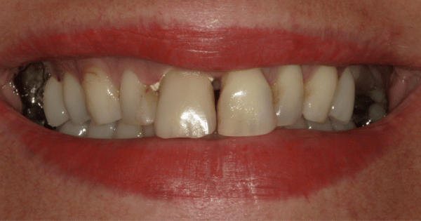 Before - North Down Dental