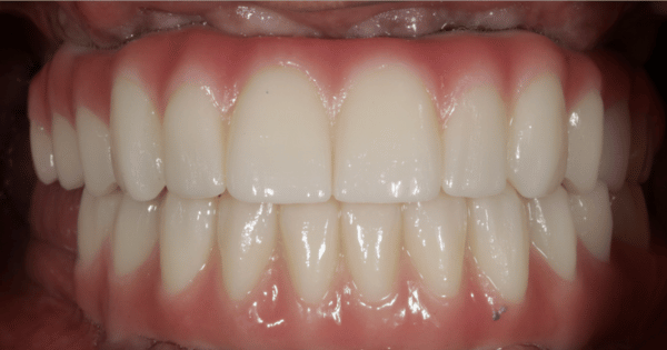 After - North Down Dental