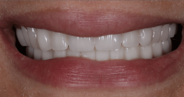 After - North Down Dental