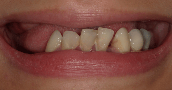 Before - North Down Dental