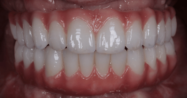 After - North Down Dental