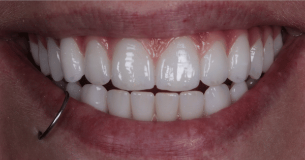 After - North Down Dental