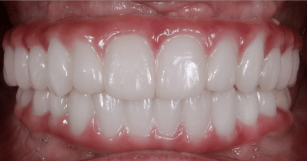 After - North Down Dental