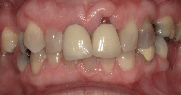 Before - North Down Dental