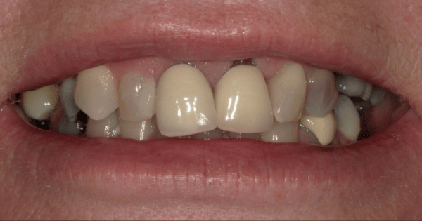 Before - North Down Dental