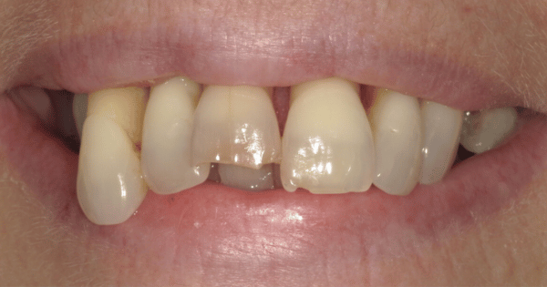 Before - North Down Dental