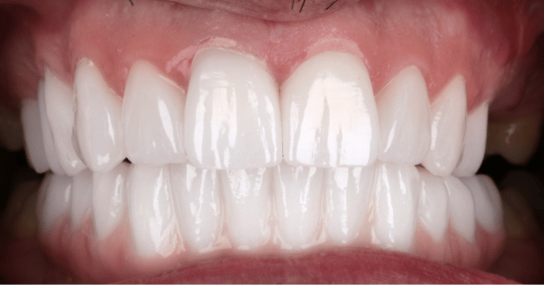 After - North Down Dental