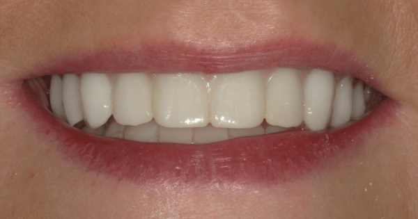 After - North Down Dental