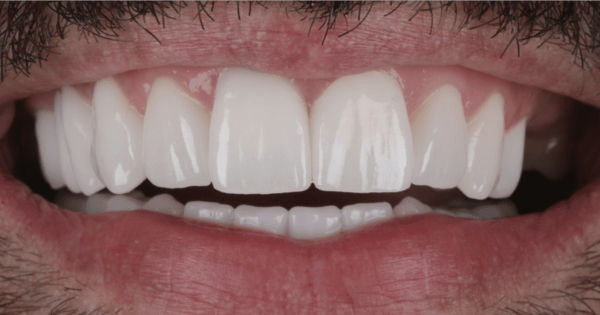 After - North Down Dental