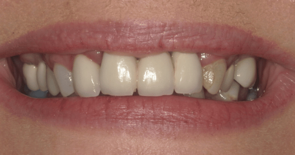 Before - North Down Dental