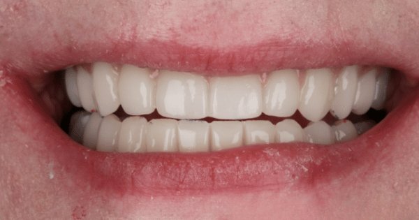 After - North Down Dental