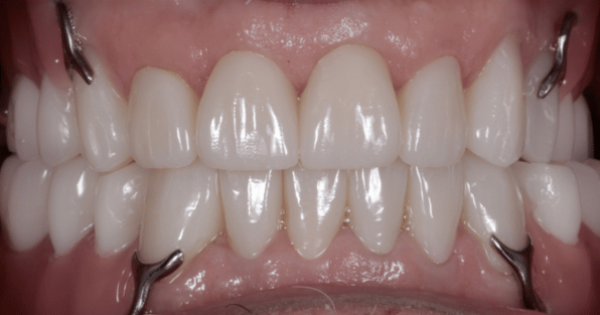 After - North Down Dental