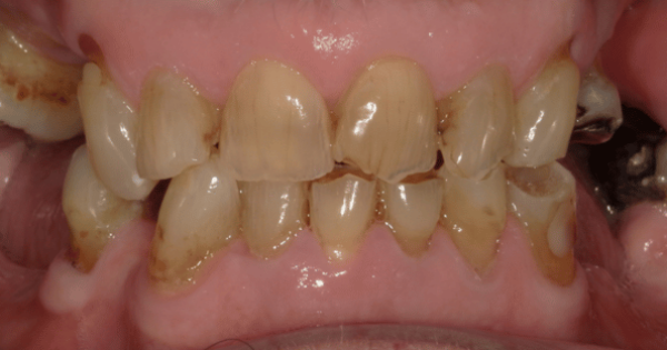 Before - North Down Dental