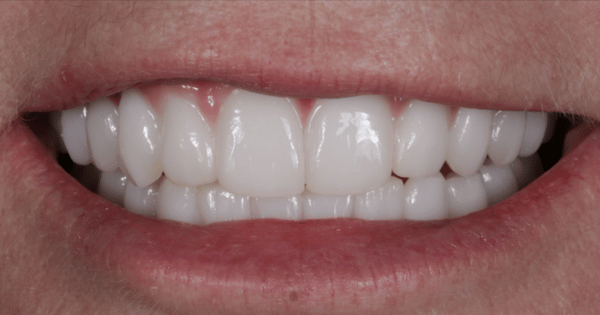 After - North Down Dental