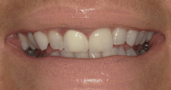 Before - North Down Dental