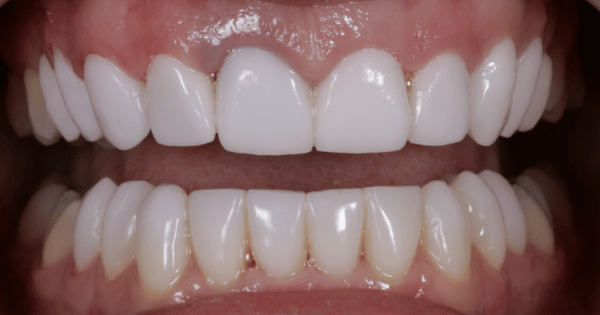 After - North Down Dental