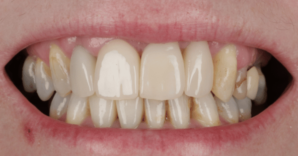 After - North Down Dental