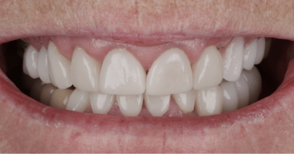 After - North Down Dental