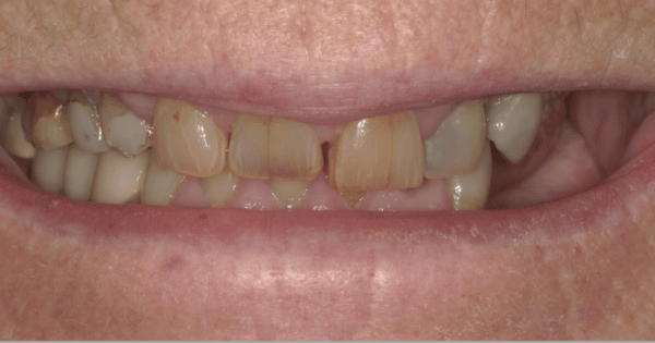 Before - North Down Dental