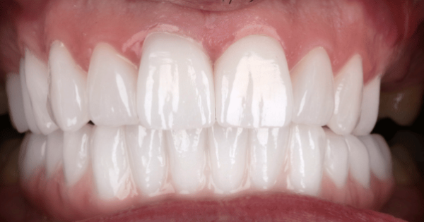 After - North Down Dental