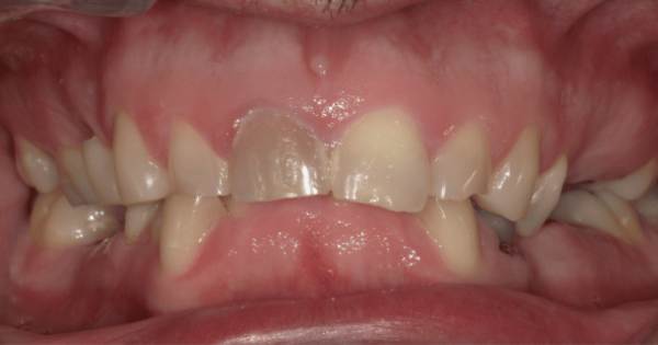 Before - North Down Dental