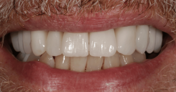 After - North Down Dental