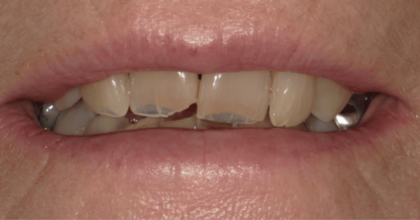 Before - North Down Dental