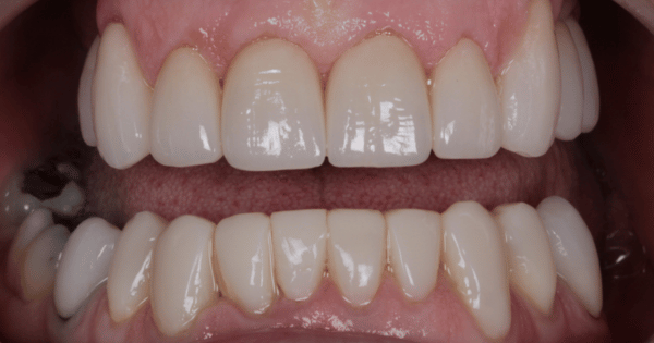 After - North Down Dental