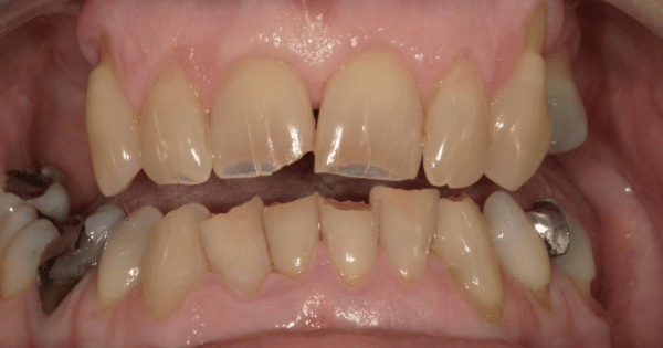 Before - North Down Dental