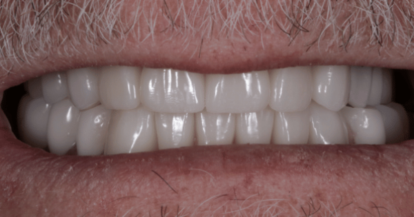 After - North Down Dental